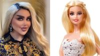 Quería parecerse a Barbie y gastó miles de dólares en 43 cirugías estéticas