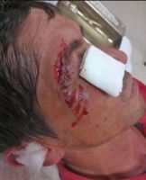 Enojado porque su caballo perdió una cuadrera, agredió y lesionó al jockey