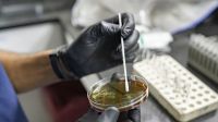 Las sanciones unilaterales y su cumplimiento excesivo dañan el derecho a la salud