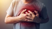 Por qué después del COVID se incrementa el riesgo de tener un infarto o un ACV